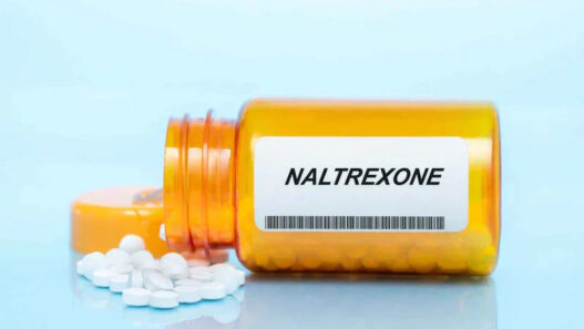 Naltrexone Weight Loss