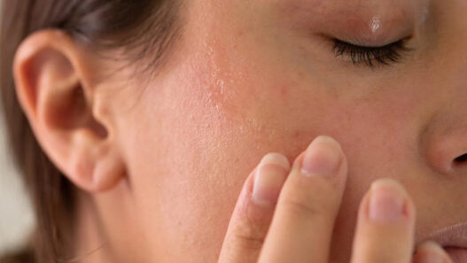 dry skin skincare