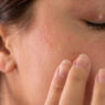 dry skin skincare
