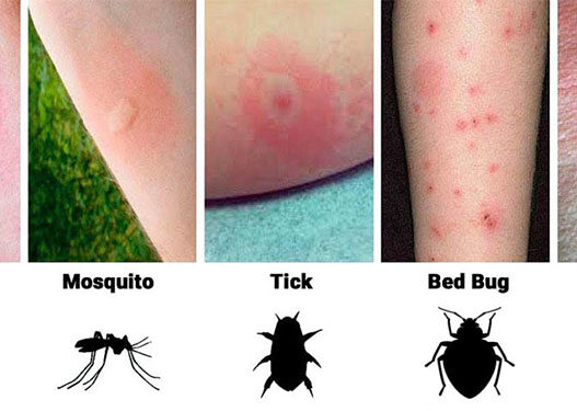 what bit me