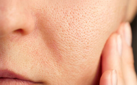 Close-up of clear complexion showing effective pore skincare