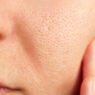 Close-up of clear complexion showing effective pore skincare