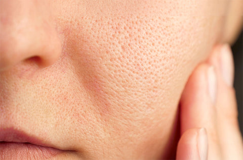 Close-up of clear complexion showing effective pore skincare